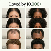 Korean Scalp Revival Bar